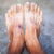 Group logo of Diabetic Foot Treatment Group
